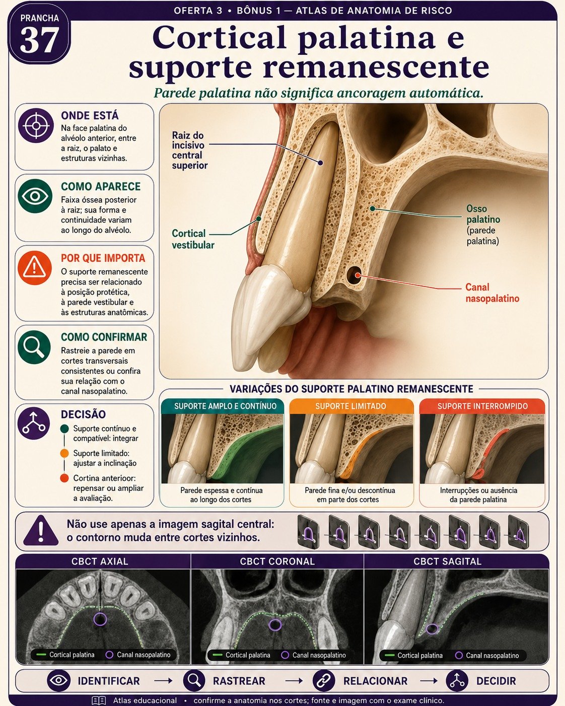 Painel visual de Tomografia em Implantodontia