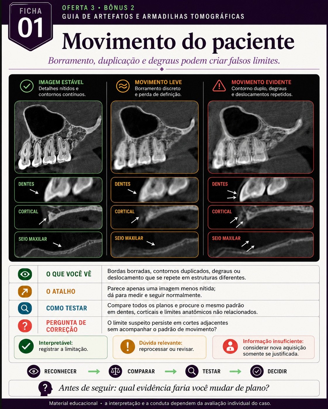Amostra de leitura tomográfica para Implantodontia